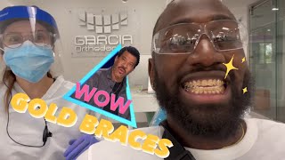 Gold Braces For Teeth: Costs, Side Effects, Benefits And More - Dentaly.Org